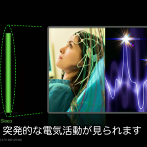 睡眠不足は10年分の老化