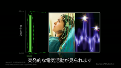 睡眠不足は10年分の老化